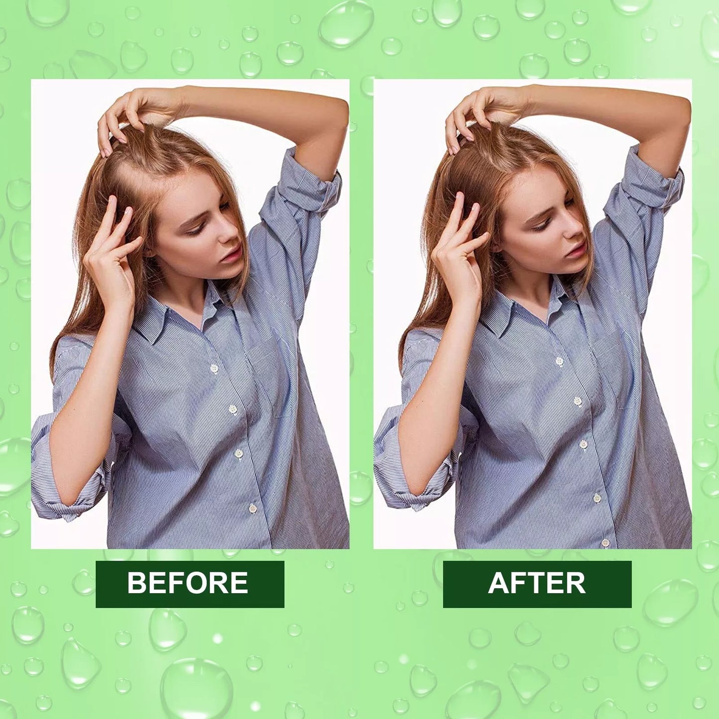 Rosemary Oil for Hair Growth